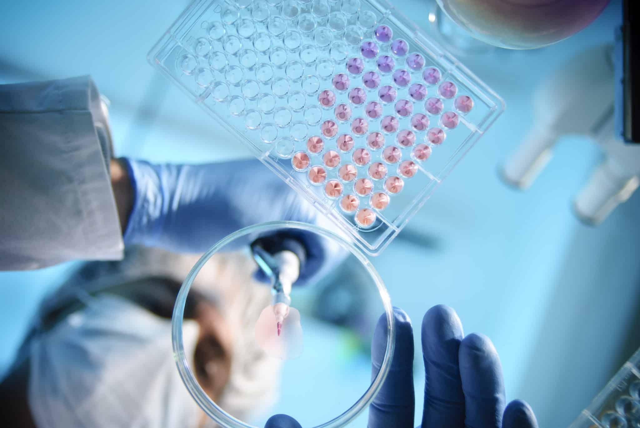 Longeveron Inc. (LGVN)’s Alzhimer’s Study-Related Rally Culminate in Corrections - Stocks Telegraph